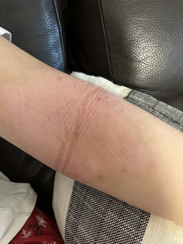 Customer photo review of Coco 濕疹修護霜 80ml