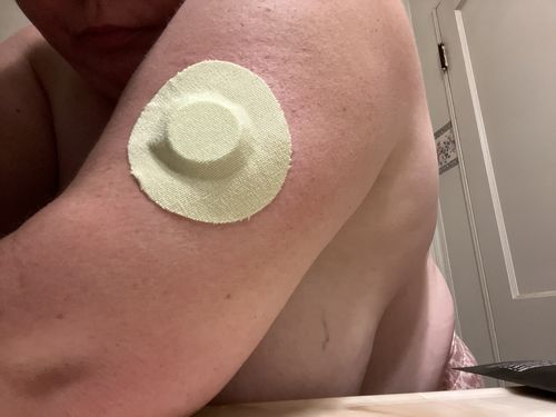 Customer photo review of Skin Grip Freestyle Libre Adhesive Patches
