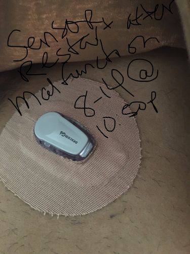 Customer photo review of Skin Grip Dexcom G6 Patches
