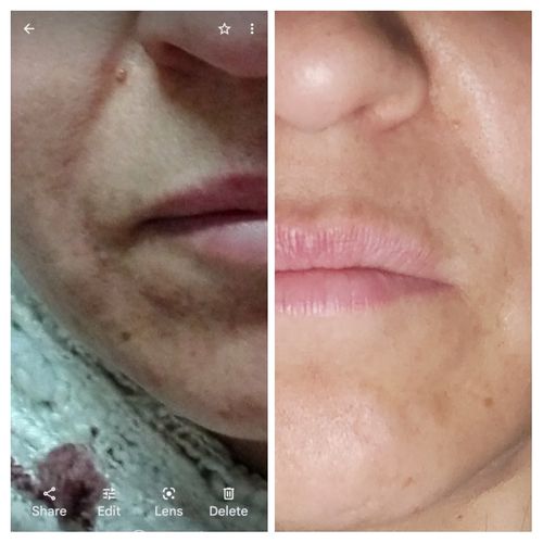 Customer photo review of Serum + crema de resveratrol
