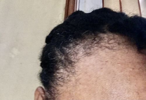 Customer photo review of [Step 6] HAIR BOOST: Nae Nae's Flagship Product