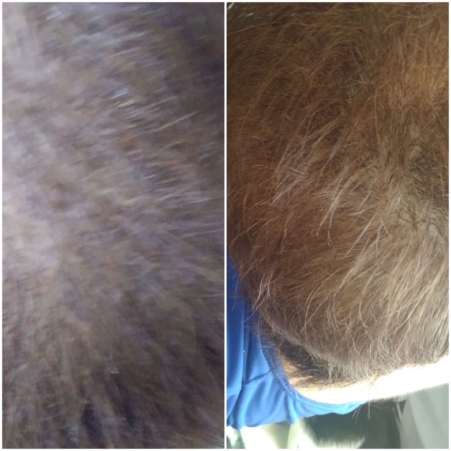 Customer photo review of Tónico anticaída + shampoo anticaída en barra