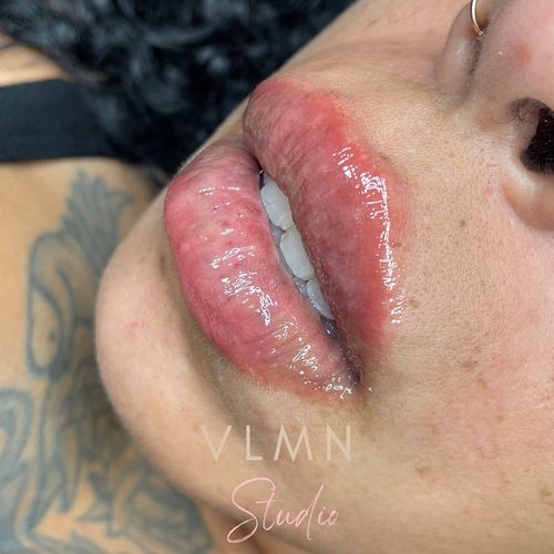 Customer photo review of Scalpa HyaInfuse