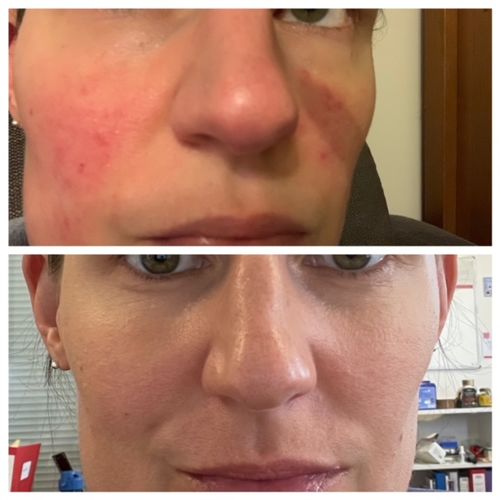 Customer photo review of Repair & Healing Set