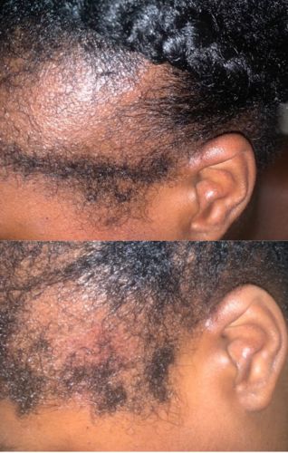Customer photo review of Hair Growth Potion - Extra Strength