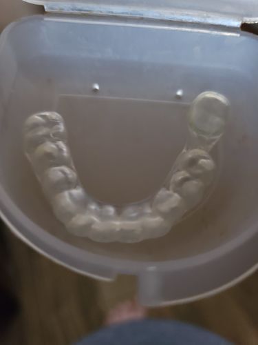 Customer photo review of Night Guard Subscription - Annual Payment Plan