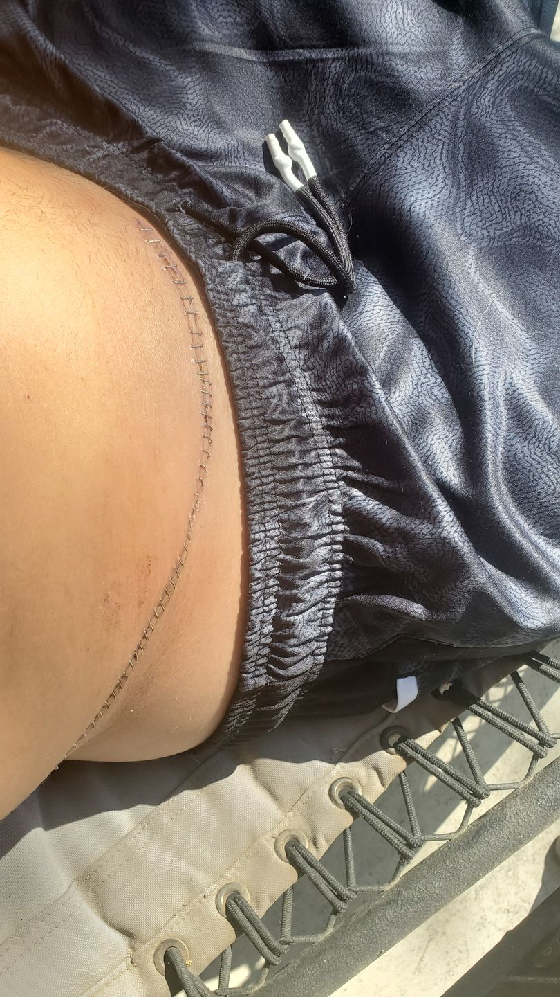 Customer photo review of Combat Ready Ointment - Triple Threat