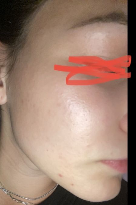 Customer photo review of [CUP]U RAW