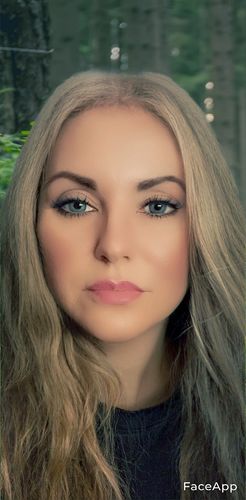 Customer photo review of Nanee Blue Contact Lenses(12 months wear)