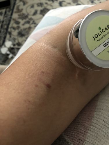 Customer photo review of Jolicare Cream