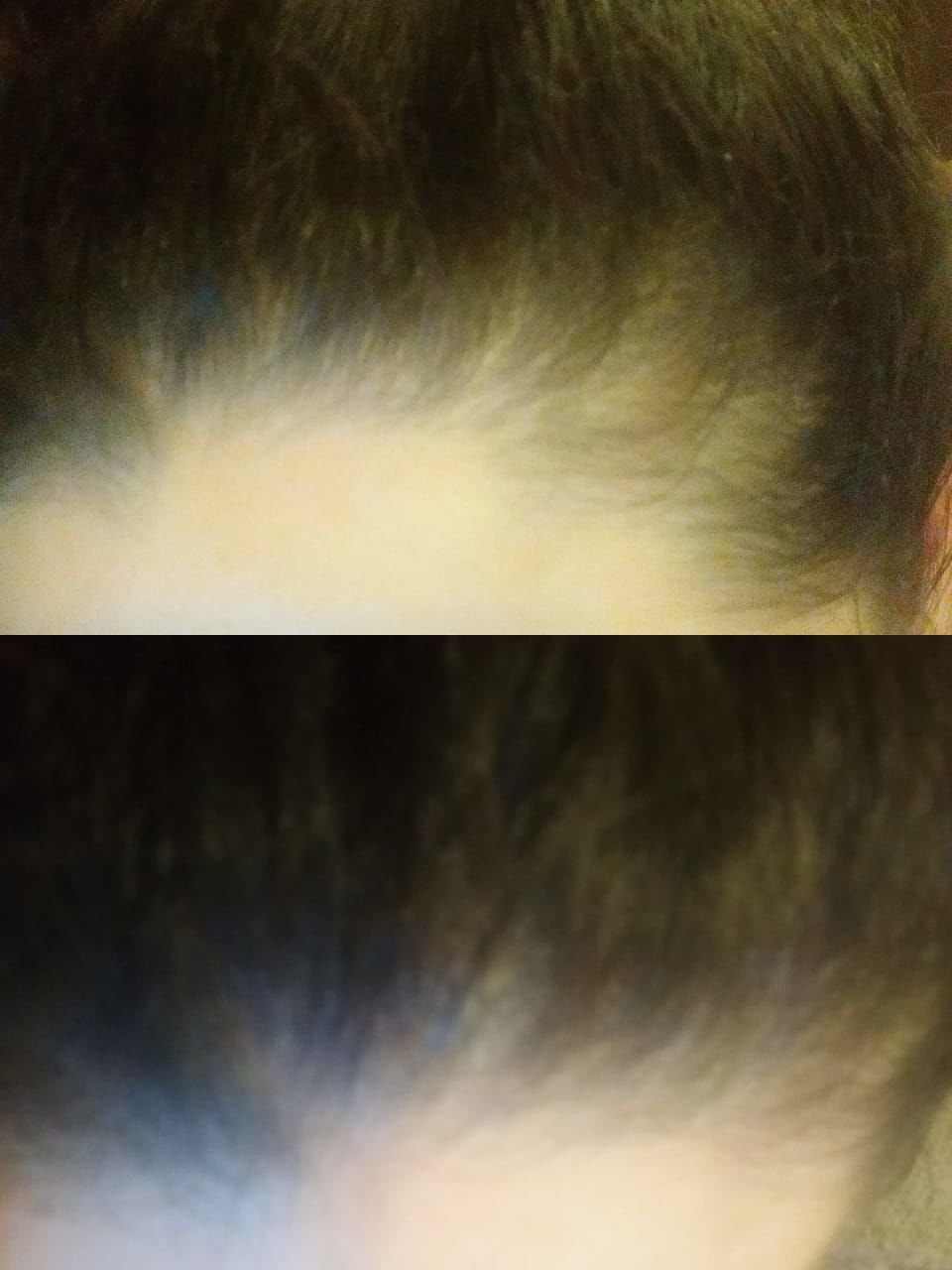 Customer photo review of SHAMPOO ANTICAIDA FORMATO BARRA