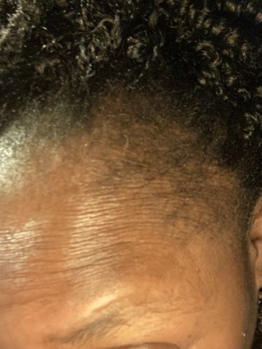 Customer photo review of Herbal Hair/Beard Growth Oil..