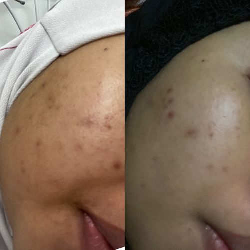 Customer photo review of Brightening Face Creme