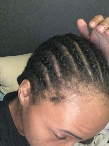Customer photo review of Rice Water Scalp Mist (PreMade)