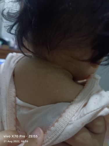 Customer photo review of Jolicare Cream