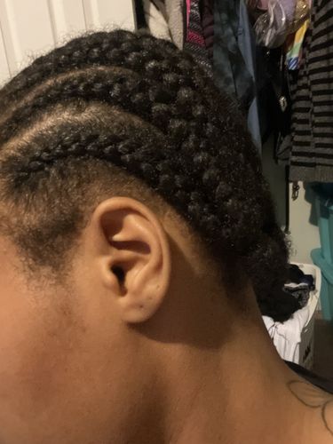 Customer photo review of Rice Oil Scalp Boost