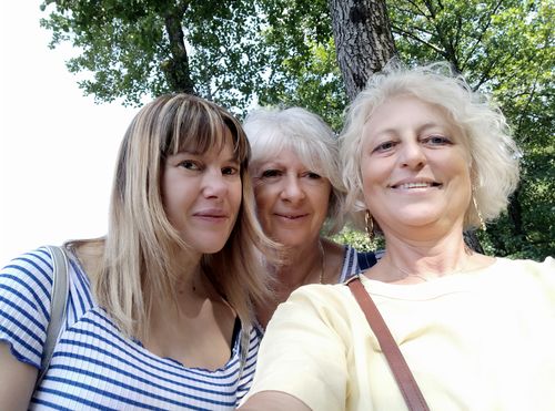 Customer photo review of [OFFERTA RISERVATA] Acido Ialuronico Puro + Bava di Lumaca Bio + RolleSkin