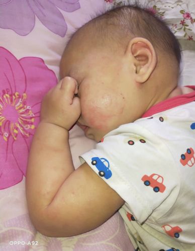 Customer photo review of Jolicare™ Cream (Baby)