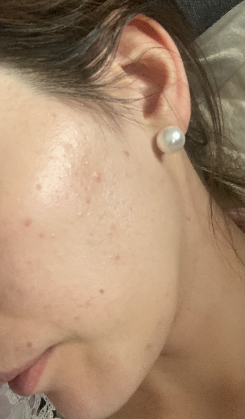 Customer photo review of Good Clean - 1 mois