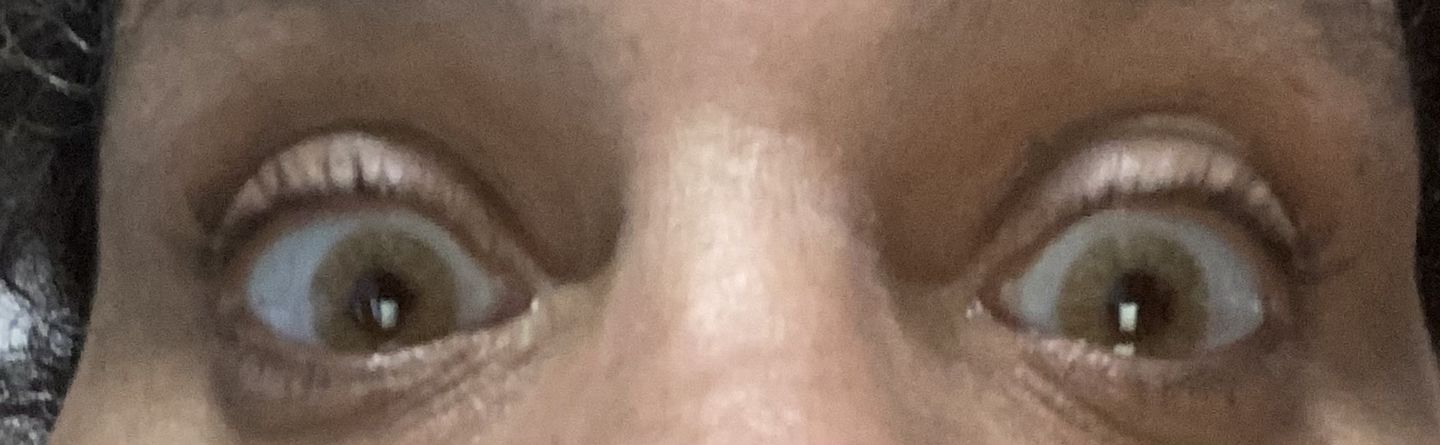 Customer photo review of Hidrocor Ocre Brown Prescription Colored Contact Lenses