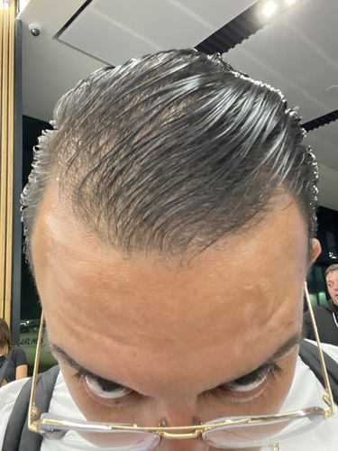 Customer photo review of HAIRtamin Fórmula Avanzada