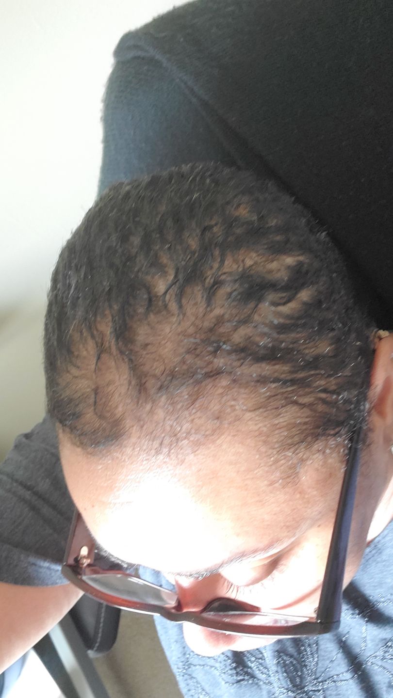 Customer photo review of Intense Deep Conditioning Treatment