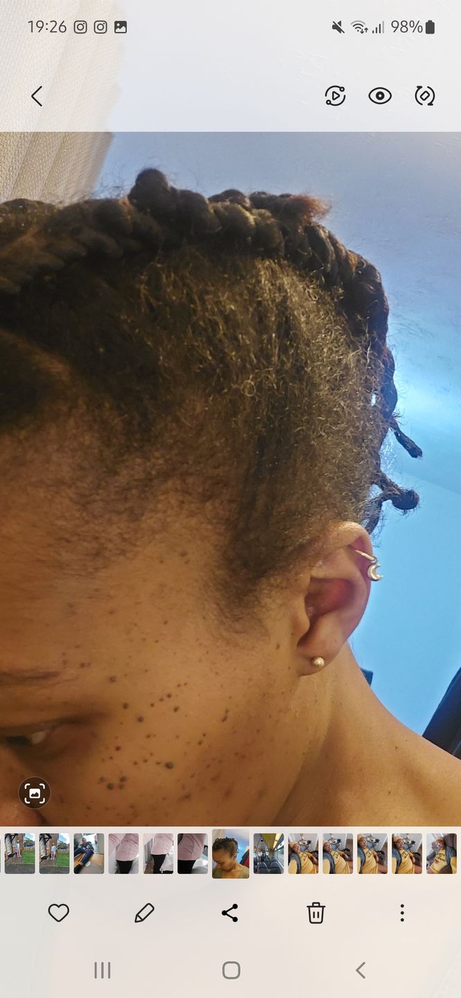 Customer photo review of Hair Growth Oil
