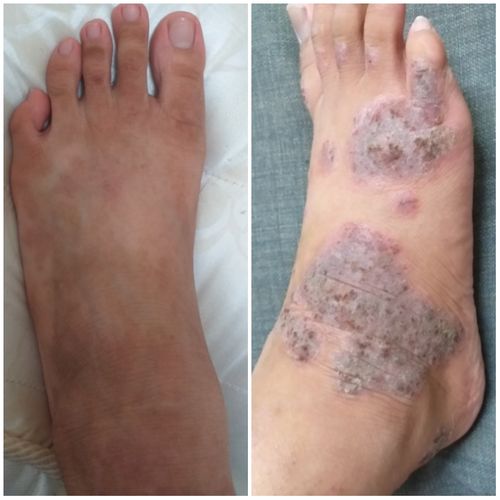 Customer photo review of Jolicare Cream