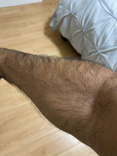 Customer photo review of GripXT™ - Grip Strengtheners 2.0