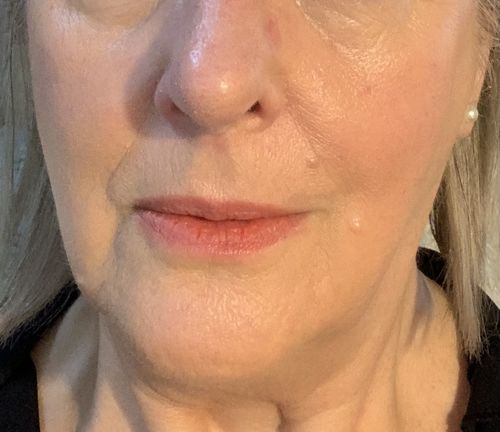 Customer photo review of Repair & Healing Set
