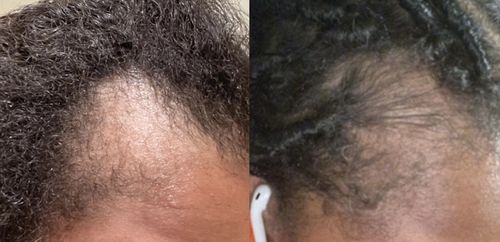 Customer photo review of Oasis