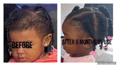 Customer photo review of The 7-Step Hair Boost Method