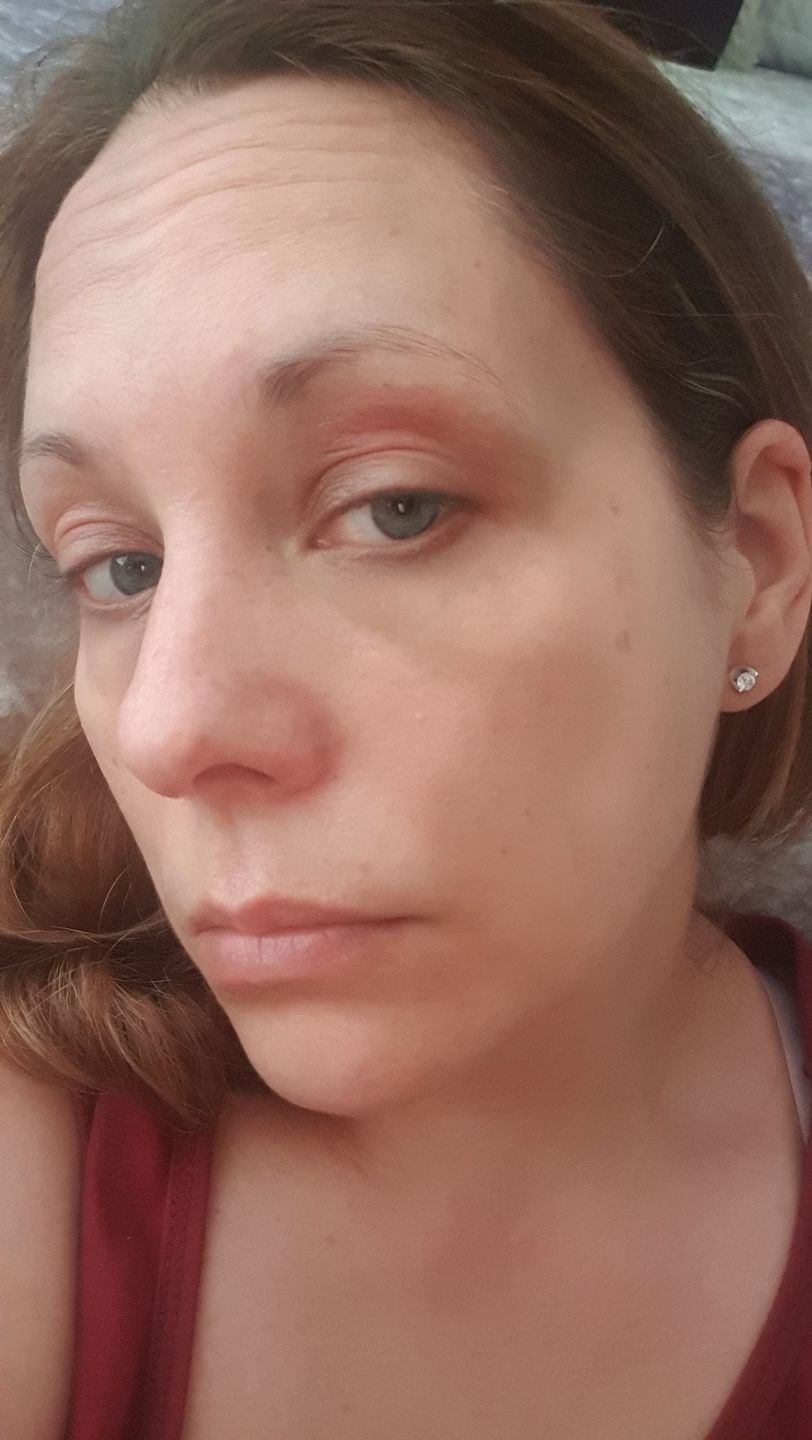 Customer photo review of Intensive Night Balm