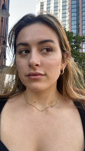 Customer photo review of LipFix: Filler