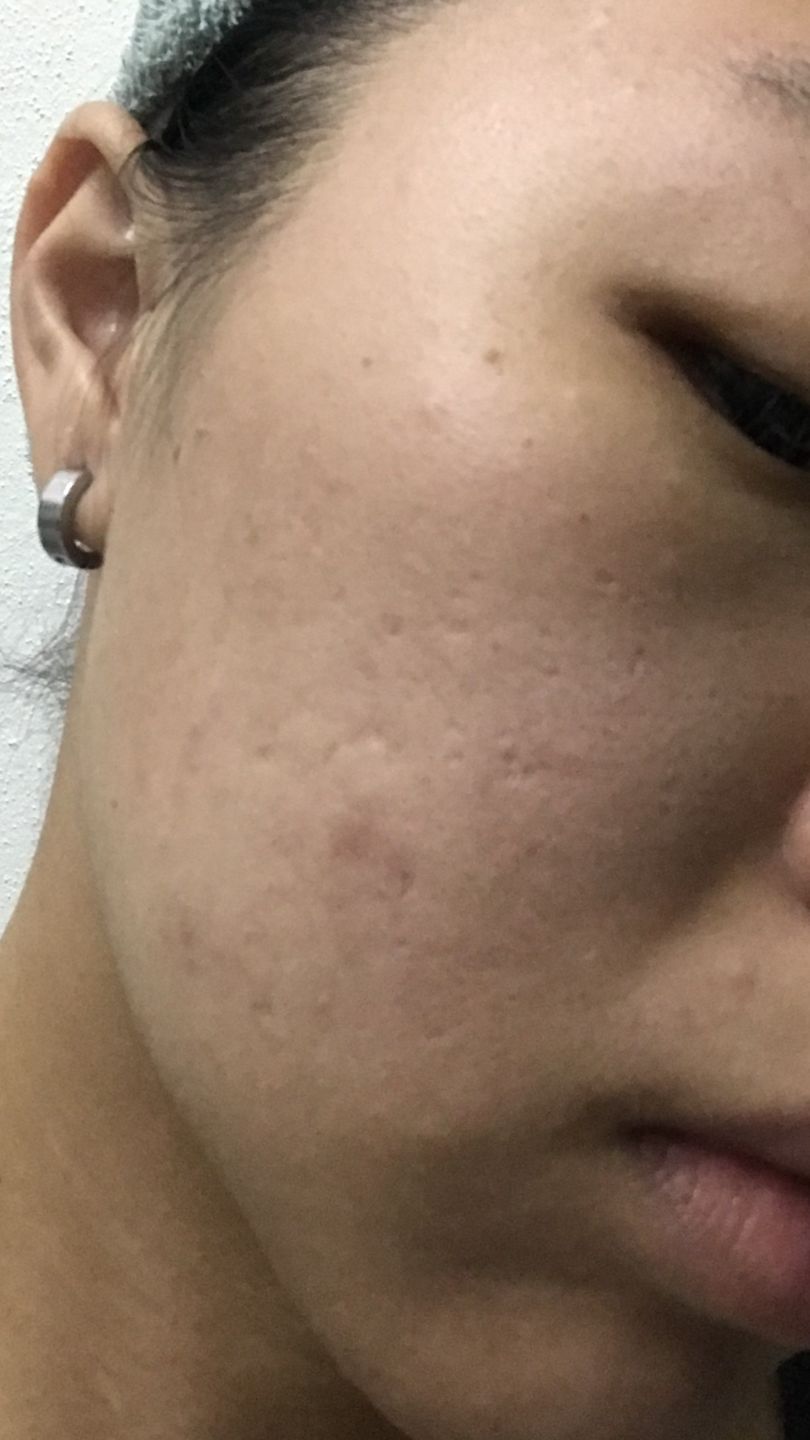 Customer photo review of CLEF Anti-Aging Cleansing Gel