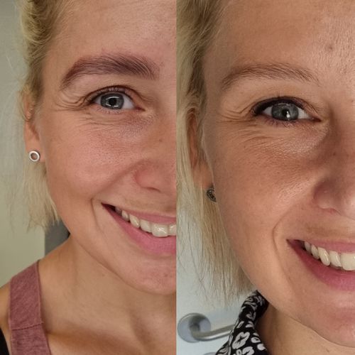 Customer photo review of Brow Lamination Kit