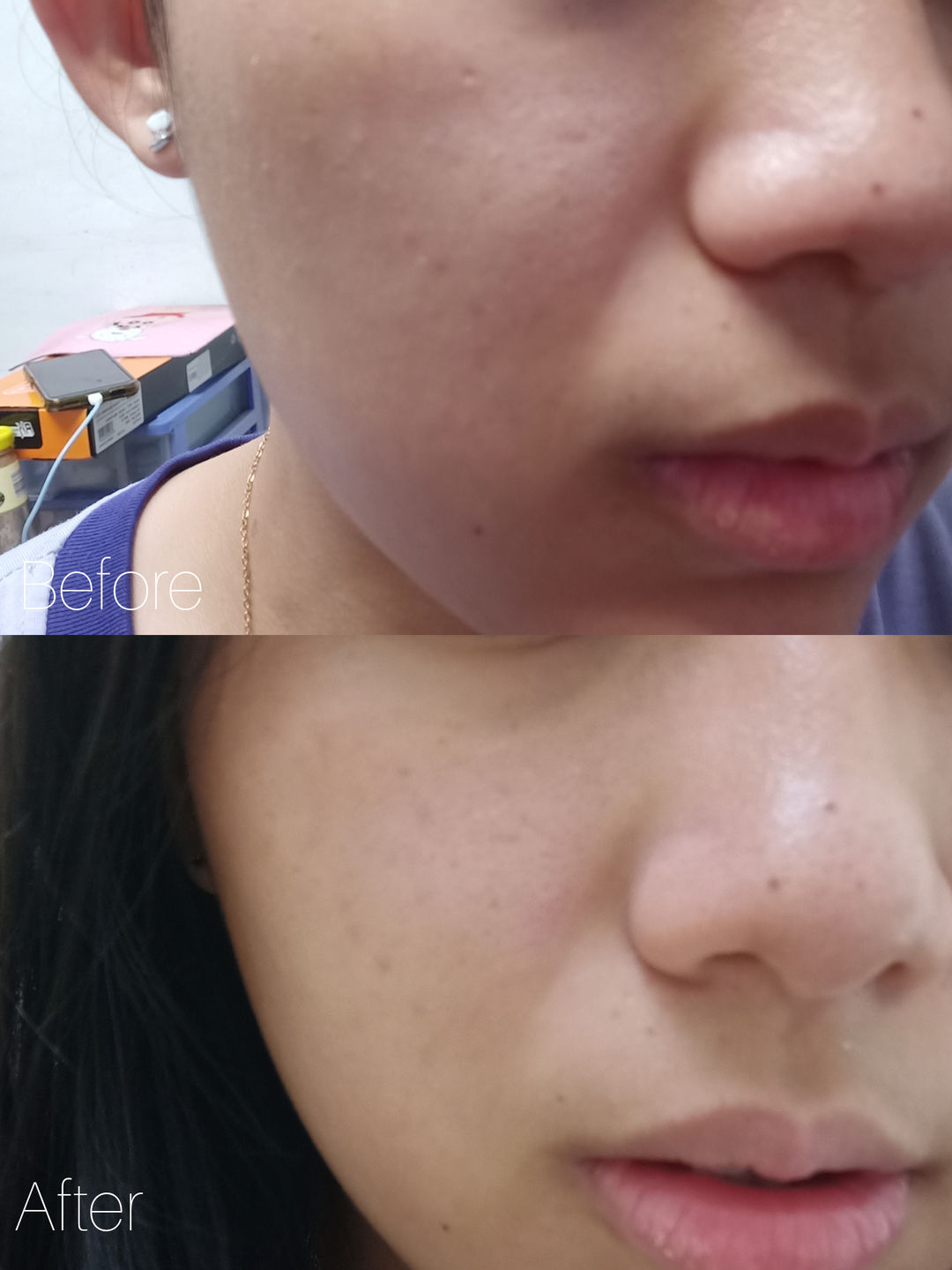 Customer photo review of CLEF RADIANT GOLD ESSENCE (30ml)