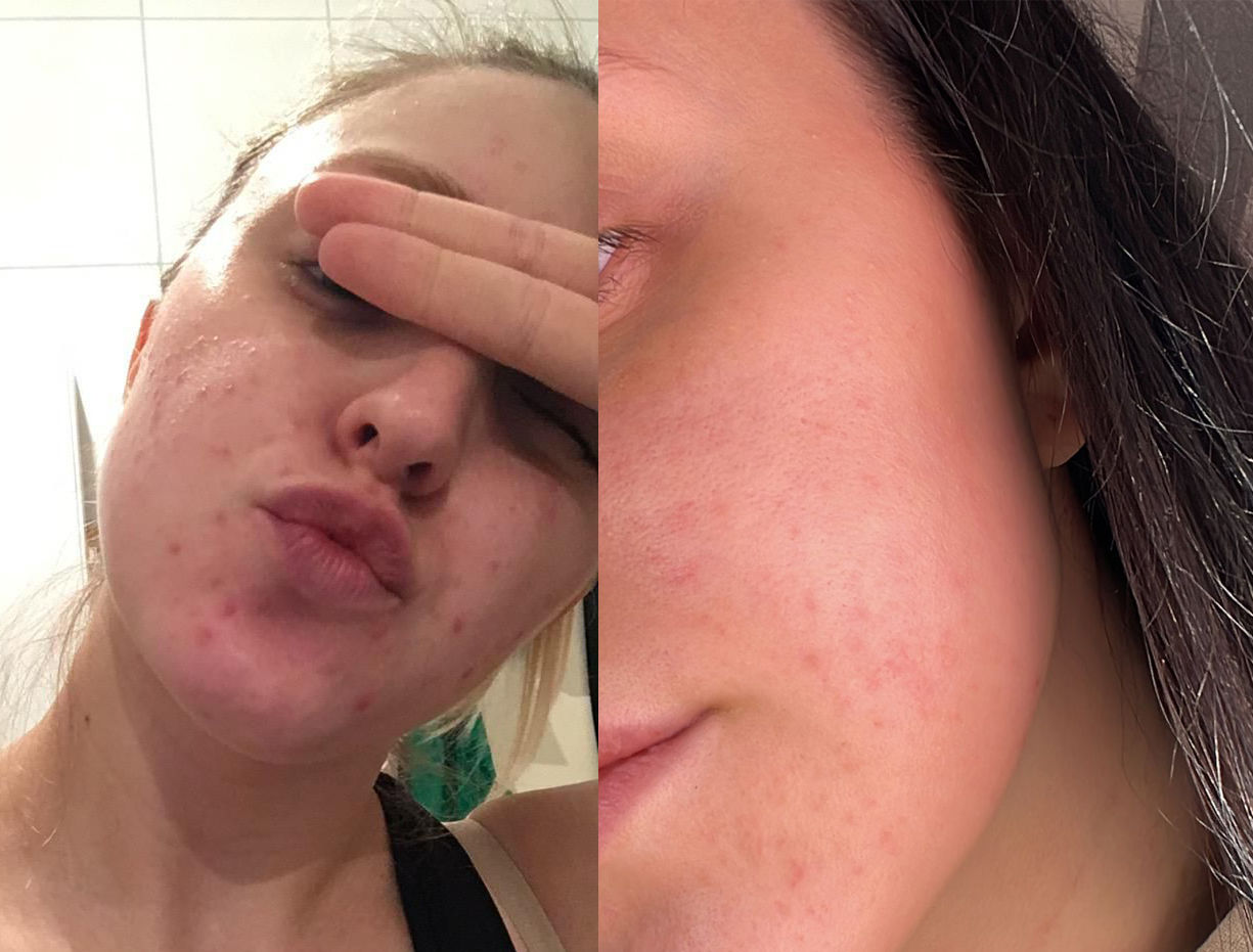 Customer photo review of Sleek Skin Serum 30ml