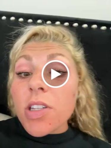 Customer video review of SHOW LASH