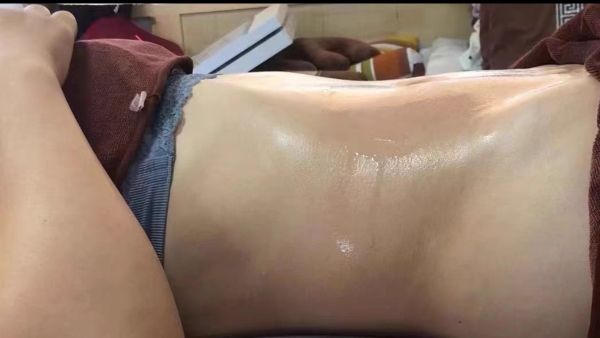 Customer photo review of Adonis 6 in 1 Cavitation Machine for Fat Blasting