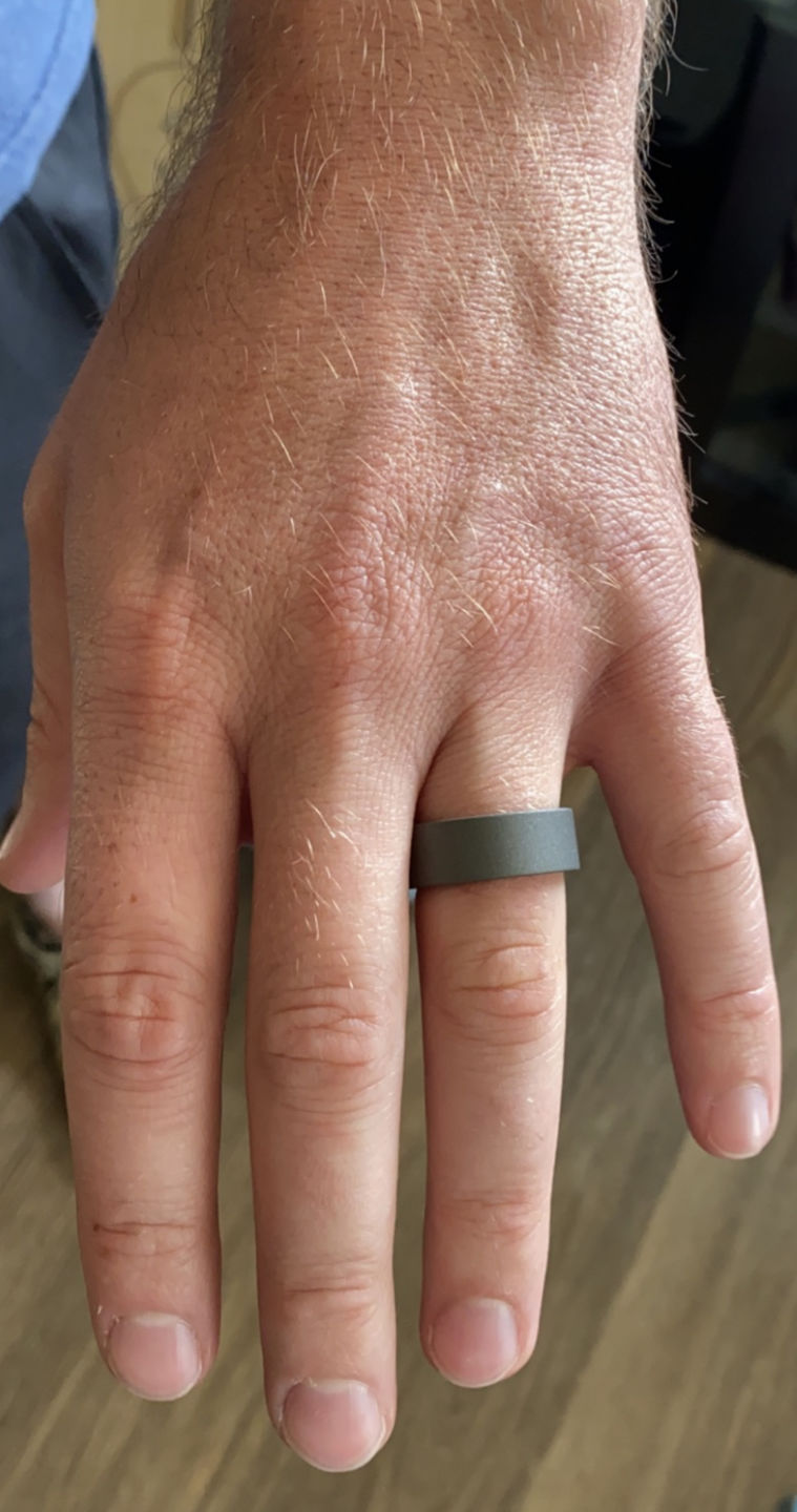 Customer photo review of WW2 Ring