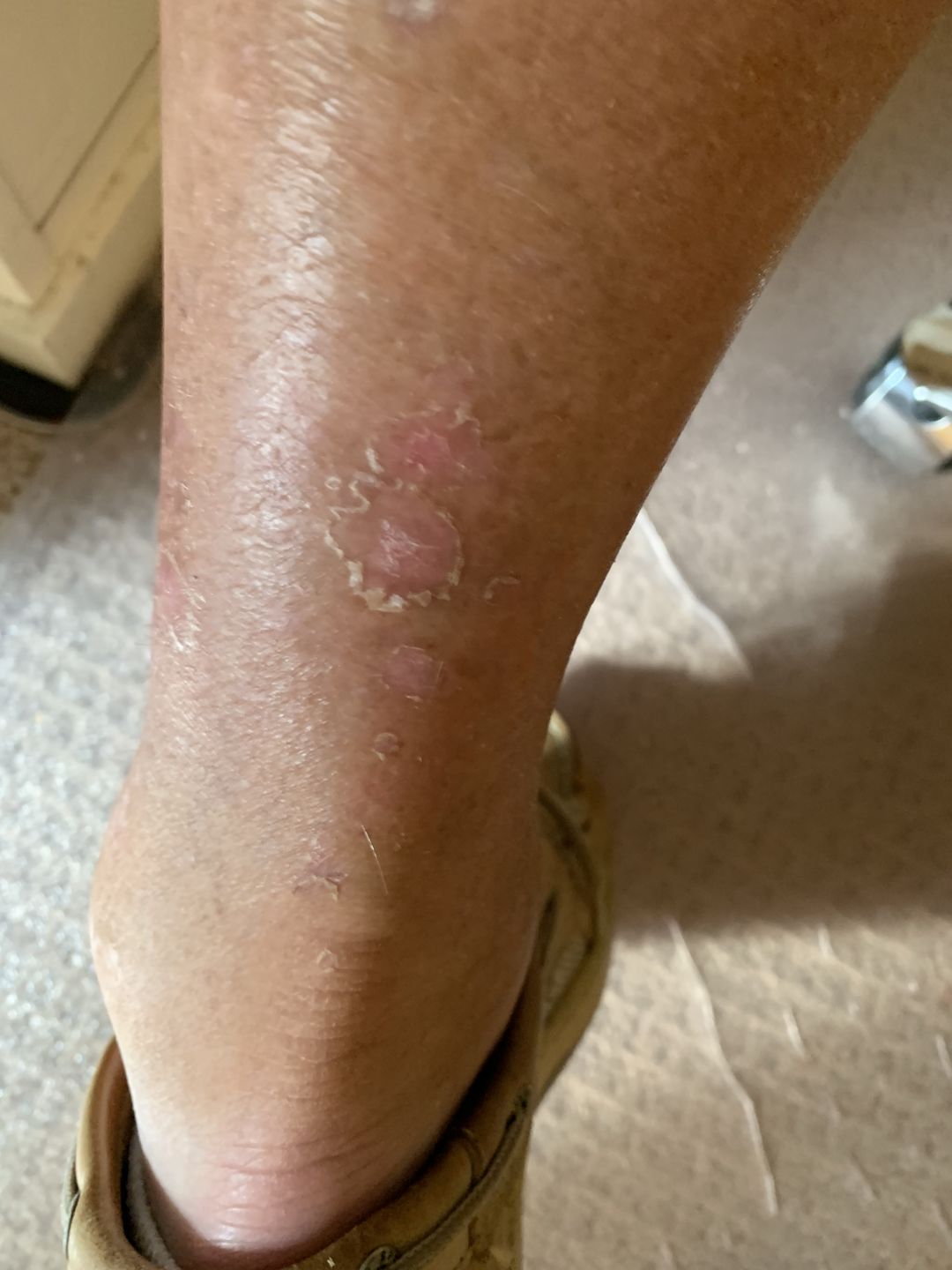 Customer photo review of Combat Ready Ointment - Big Tin