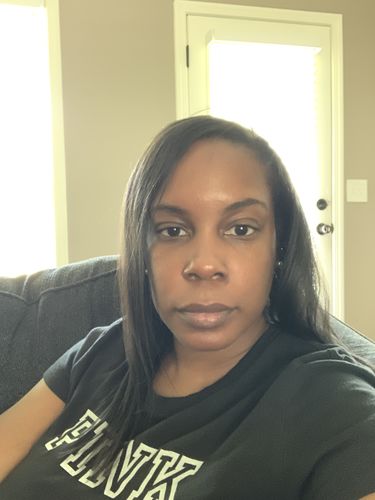 Customer photo review of BERRI-CLEAR+ 5 BERRY SUPERFRUIT SERUM