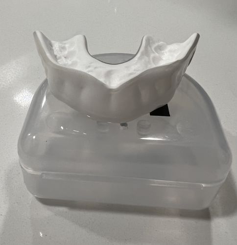 Customer photo review of ARC (Upper)