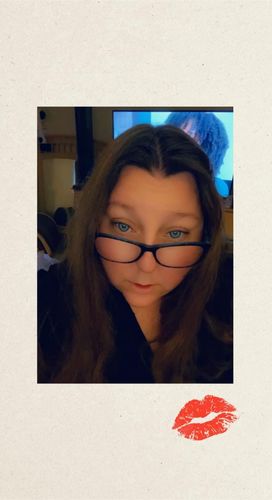 Customer photo review of Himalaya Blue Contact Lenses(12 months of use)