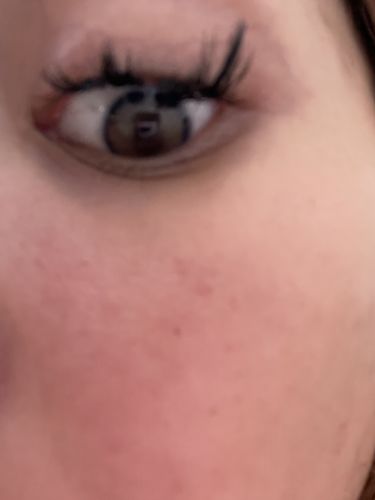 Customer photo review of Neala Brown Contact Lenses(12 months wear)