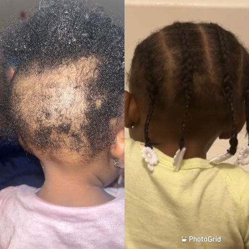 Customer photo review of BEST SELLER! | Chad and India’s Root to Tip Bundle| 4 sizes to choose from