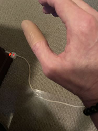 Customer photo review of THUMB TIP BY TCC