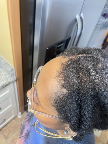 Customer photo review of Hair Recovery Bundle