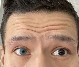 Customer photo review of 2Dadoll Gin Blue Contact Lenses(1 pair/6 months)